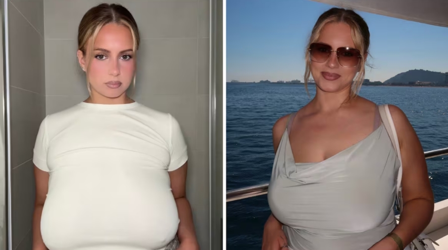 Woman Gets Life-Changing Breast Reduction From Size ’36G to 36C’